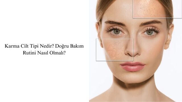 Cilt Tipin Hem Yağlı Hem Kuru mu? İşte Karma Ciltler İçin Etkili Bakım Yöntemleri