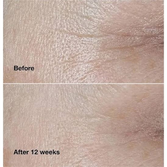 Clinique Smart Clinical Repair 75 ml Kırışıklık Karşıtı Krem - 4