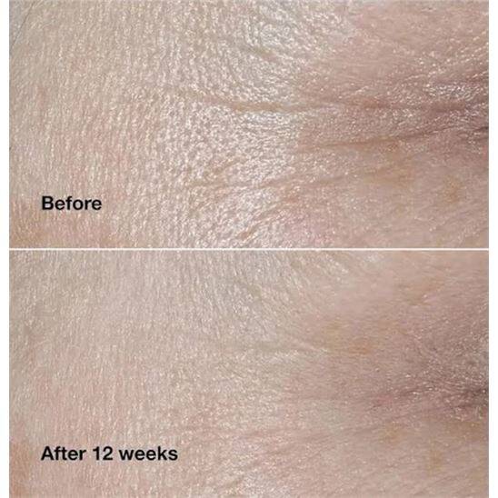 Clinique Smart Clinical Repair 75 ml Kırışıklık Karşıtı Krem - 4